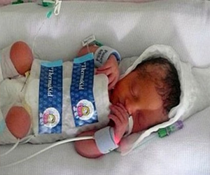   مصر اليوم - تجميد طفلة لـ 3 أيام ينقذها من الموت