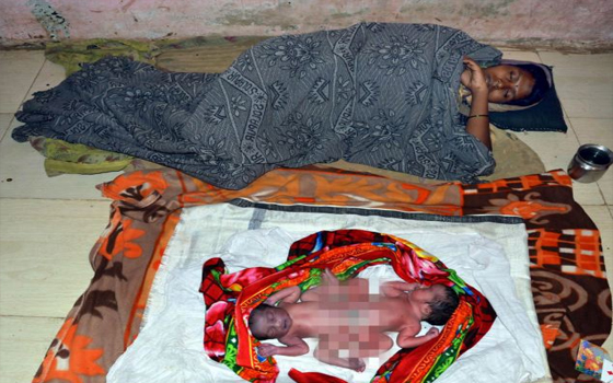   مصر اليوم - هندية تلد توأمين بمعدة مشتركة في المنزل بدلاً من المستشفى