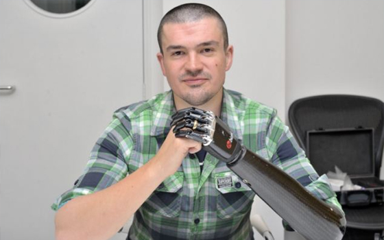   مصر اليوم - شركة بريطانية تطور يد صناعية لتسمح بارتداء خاتم الزواج