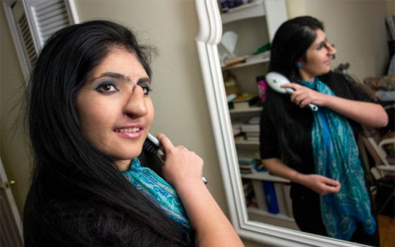 مصر اليوم - 3 أسابيع على إكمال سلسلة العمليات الجراحية لتحصل عائشة على أنف جديد