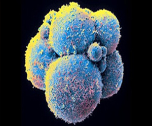   مصر اليوم - تصوير جديد ثلاثي الأبعاد لرؤية الأورام السرطانية المخفية