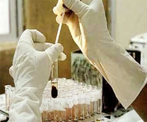   مصر اليوم - وفاة أول مقيم عربي في السعودية لسبب فيروس كورونا