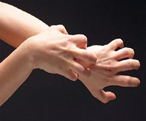   مصر اليوم - اكتشاف مادة كيميائية تسبب الرغبة في حكة الجلد