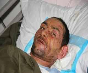   مصر اليوم - لبنان:4 جرحى سوريين في انفجار قارورة غاز