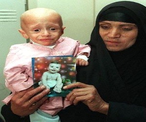   مصر اليوم - نصف سكان البصرة مصابون بمرض السرطان