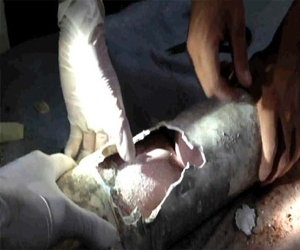   مصر اليوم - أم رضيع أنبوب الصرف الصحي: آسفة