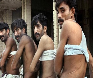   مصر اليوم - بيع الأعضاء تجارة ينعشها الفقر