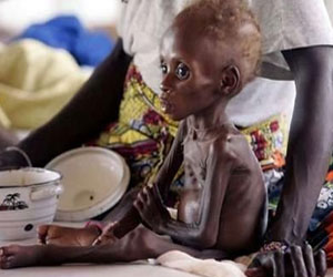   مصر اليوم - سوء التغذية يتسبب بخسارة 5% من الناتج العالمي