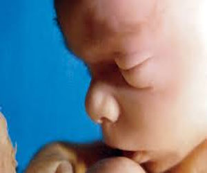   مصر اليوم - صحة الكلية تتشكل قبل الولادة