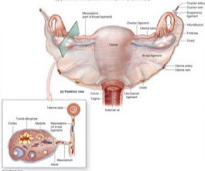   مصر اليوم - اختبارات سريعة لقياس نسب التبويض