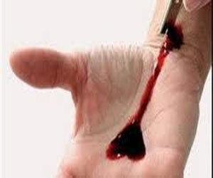   مصر اليوم - نيابة الغردقة تبدأ التحقيق في واقعة محاولة انتحار سائحة روسية