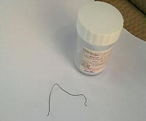 مصر اليوم - طبيب سعودي ينسى خيطًا في جوف سيدة بعد ولادة قيصرية