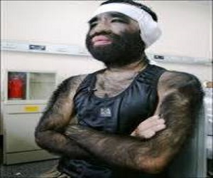   مصر اليوم - الرجل صيني تشانغ يونغ يتحول إلى قرد