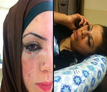   مصر اليوم - فلسطينيتان تتعرضان للضرب على أيدي اليهود