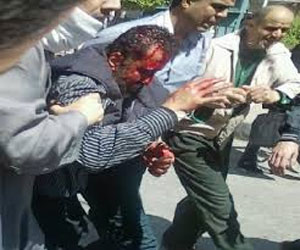   مصر اليوم - إصابة 5 في اعتداء على مسيرة القوى السياسية الرافضة لمحافظ الدقهلية