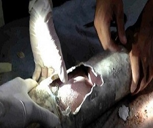   مصر اليوم - رضيع حي بعد بقاءه يومين داخل بالوعة في إسبانيا