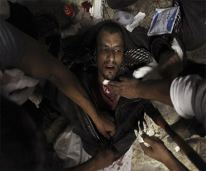   مصر اليوم - 79 مصابًا بين متظاهري الإسكندرية بينهم 9 من الأمن