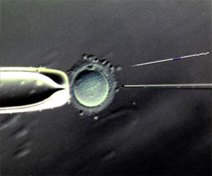   مصر اليوم - تقنية التلقيح الثلاثي تثير جدلاً في بريطانيا