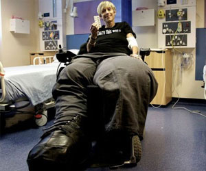   مصر اليوم - امرأة تُعاني من عدم توقف نمو قدميها