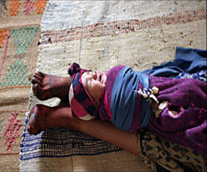   مصر اليوم - ارتفاع  وفيات الأمهات والأطفال في موريتانيا