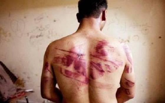   مصر اليوم - 30منظمة حقوقية توثق أساليب التعذيب التي تعرض لها الناجين من السجون السورية