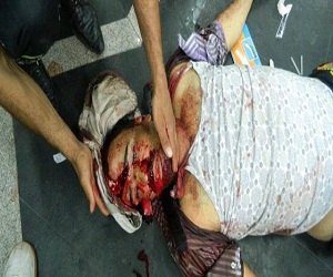   مصر اليوم - حماس تدين مجزرة الحرس الجمهوري في البلاد