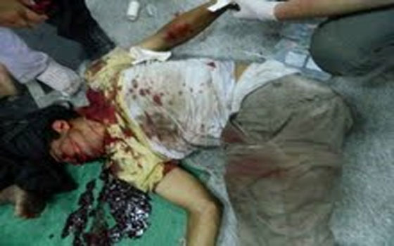   مصر اليوم - قاطنو العقارات القريبة من مقر الحرس الجمهوري يسردون تفاصيل الأحداث