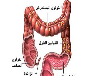   مصر اليوم - الإصابة بزوائد القولون نتيجة لعوامل وراثية