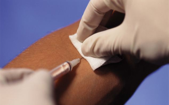 مصر اليوم - البصمة الكميائية في الدم يمكن أن توفر أدلة على الصحة في المستقبل