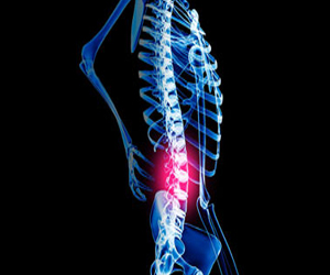   مصر اليوم - امرأة أميركية تبحث عن جراح يفصل عمودها الفقري لتصاب بالشلل