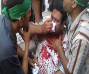   مصر اليوم - النور يستنكر سقوط شهداء في المنصورة