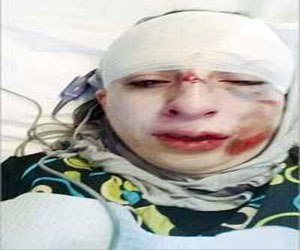   مصر اليوم - سائق رباعية سوداء سحل فيليبينية بعد فشله في سرقة حقيبتها