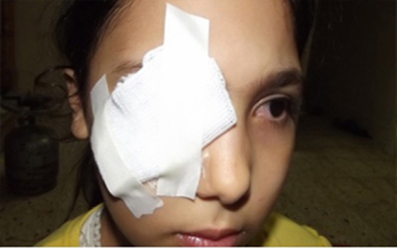   مصر اليوم - تقى ضحيّة تحريض إعلام مصر ضد السوريين