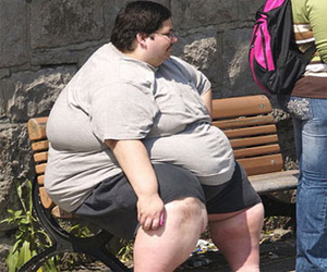   مصر اليوم - البدانة والأطعمة السيئة المسؤول الأول عن أمراض الكبد