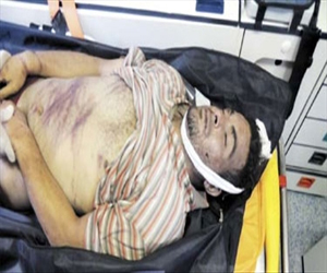   مصر اليوم - الأمن المصري يتعرف على أحد ضحايا رابعة