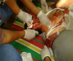 مصر اليوم - إصابة جندي في هجوم على الأمن في العريش