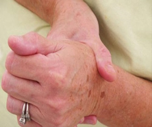   مصر اليوم - بروتين البرولاكتين يخفض من التهابات المفاصل