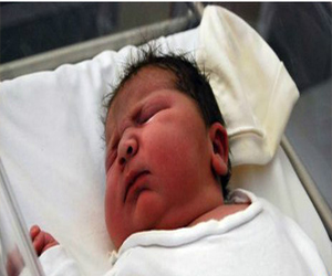   مصر اليوم - سيدة بريطانية تلد أضخم طفلة في أسبانيا