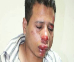   مصر اليوم - الوطني لحقوق الإنسان يستنكر الاعتداء على محرر فيتو