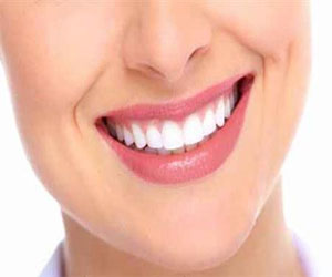 مصر اليوم - كيف تتجنبين ظهور بقع الأسنان