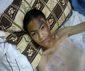 مصر اليوم - الأردن اعتداءات على أطفال من ذوي الاحتياجات الخاصة داخل دور رعاية