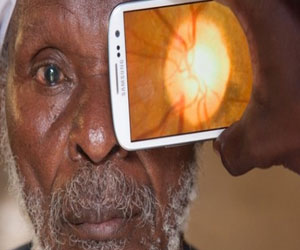 مصر اليوم - تطبيق للهواتف الذكية قادر على تشخيص أمراض العين