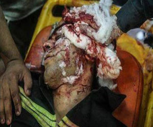   مصر اليوم - 50 سيارة إسعاف تشارك في جنازة شهيد الإسعاف برابعة