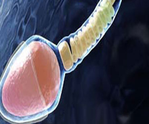 مصر اليوم - تناول الصودا بكثرة يخفض الحيوانات المنوية للرجال وتزيد وفيات السيدات