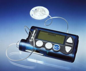 مصر اليوم - مضخات الأنسولين الأفضل في توصيل الجرعة لمريض السكر من الحقن