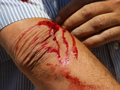   مصر اليوم - الاحتلال يصيب العشرات في مظاهرات الضفة ضد الاستيطان