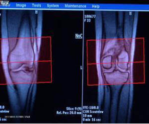   مصر اليوم - الكالسيوم مع الفيتامين 'د' لا يخفّف آلام المفاصل
