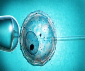   مصر اليوم - نجاح أول عملية زراعة للمبيض خارج الرحم في أستراليا