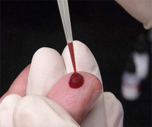   مصر اليوم - اختبار بسيط للدم لتحديد بروتين يكشف إصابة عضلة القلب بالضرر