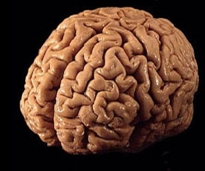   مصر اليوم - إس آر إس طريقة جديدة لتحليل نسيج الورم الدماغي قبل الجراحة